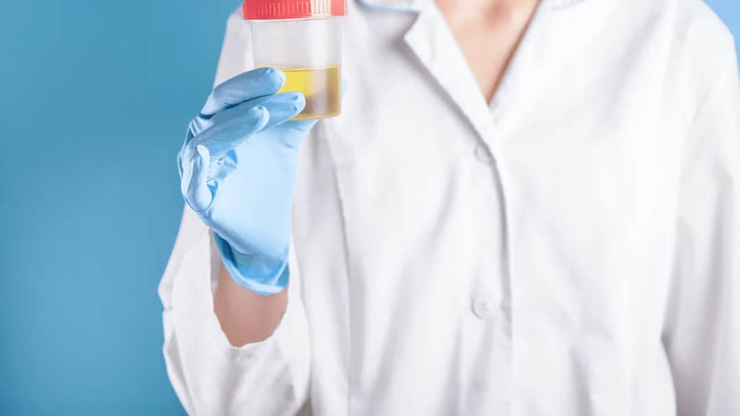 Jak pobrać mocz od suki i uniknąć problemów zdrowotnych psa